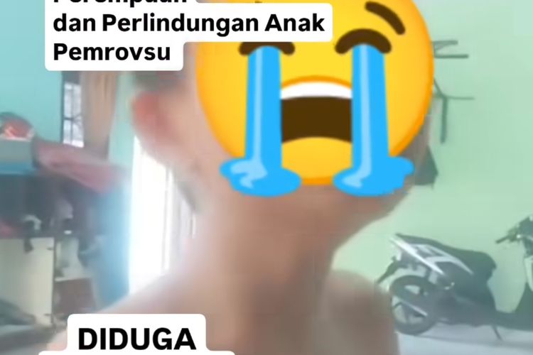 ASN Dinas Perlindungan Anak Siram Anak Tiri Pakai Air Panas, Suami Memaafkan